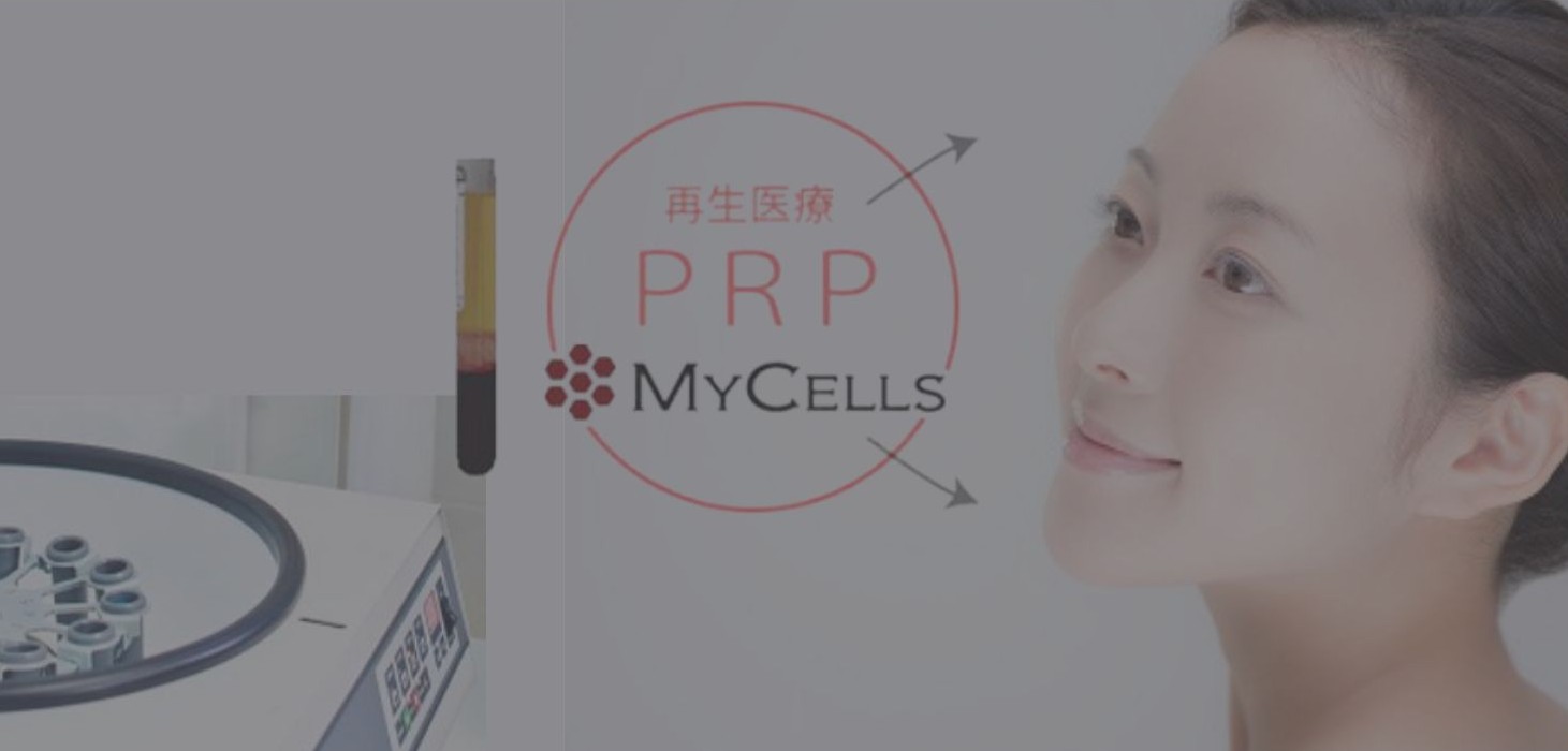 PRP再生医療